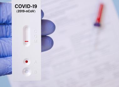 Изследване с антигенни тестове за COVID-19